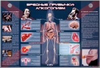 Электрифицированный стенд "Вредные привычки: алкоголизм" - «globural.ru» - Краснотурьинск